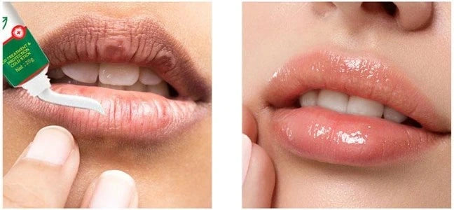 HerbalLipstick - Bálsamo Labial Medicinal a Base de Hierbas