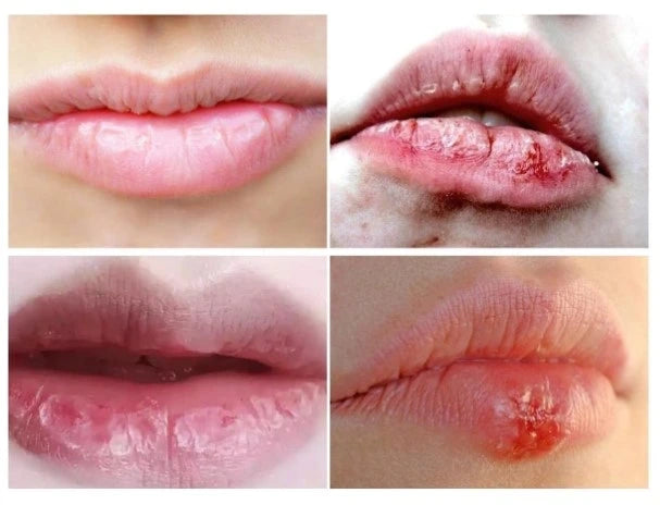 HerbalLipstick - Bálsamo Labial Medicinal a Base de Hierbas