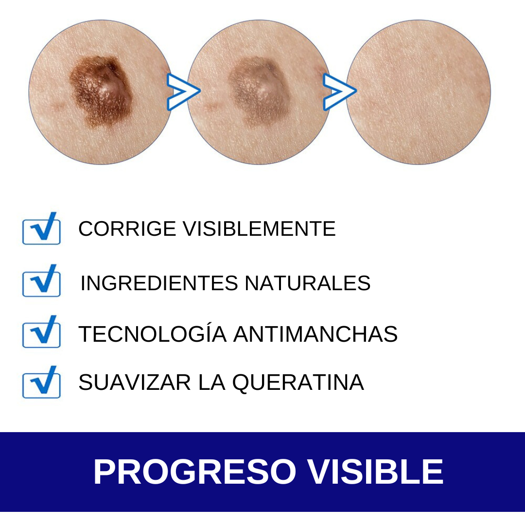 WartRemover - Crema para eliminar Lunares y Verrugas, Ungüento medicinal para eliminar manchas oscuras