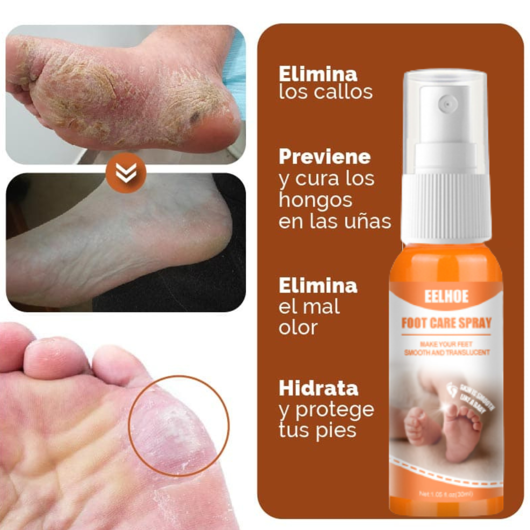 ByeCallus - Spray Exfoliante para el Cuidado de los pies - Dile Adiós a los Callos