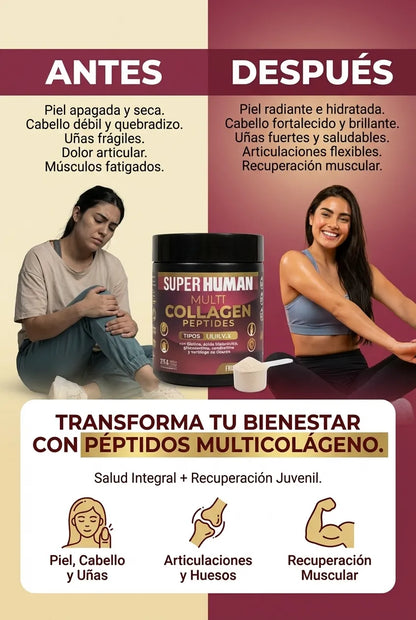 Multi Collagen Peptides™ - Colágeno Hidrolizado en Polvo Tipo I, II, III, V y X con Glucosamina, Biotina, Condroitina y Cartílago de Tiburón, para Piel, Articulaciones y Huesos, 100% Puro y Natural (375 g) - SuperHuman™