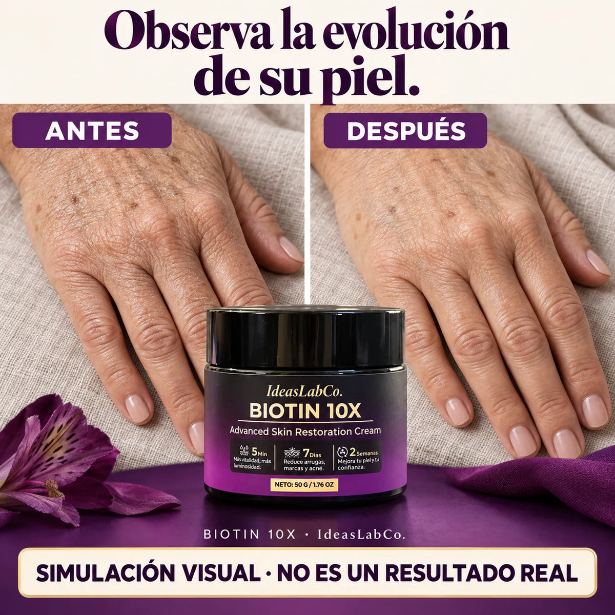 BIOTIN 10X Crema Tópica con Biotina (50g)