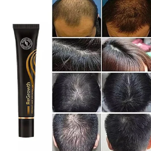 Regrowth™ Serum De Biotina Crece Cabello 20 Ml, imagen 2