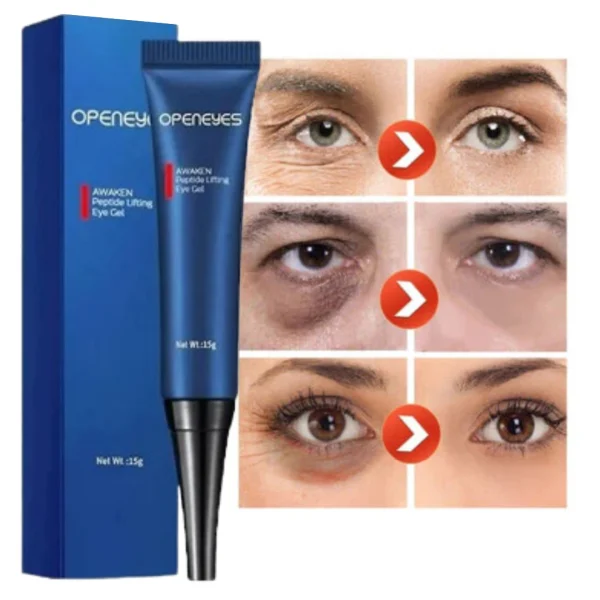 Openeyes - Crema Anti-Ojeras con Retinol AntiEdad, imagen 4