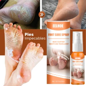 ByeCallus - Spray Exfoliante para el Cuidado de los pies - Dile Adiós a los Callos