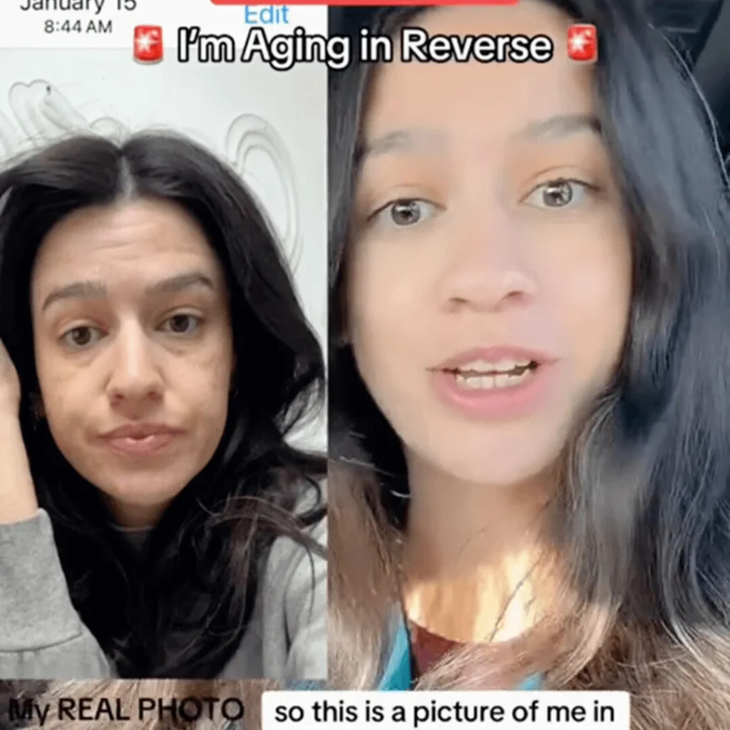 ¡Redescubre tu juventud con NAD+ y Resveratrol! – Antes – NAD + Resveratrol