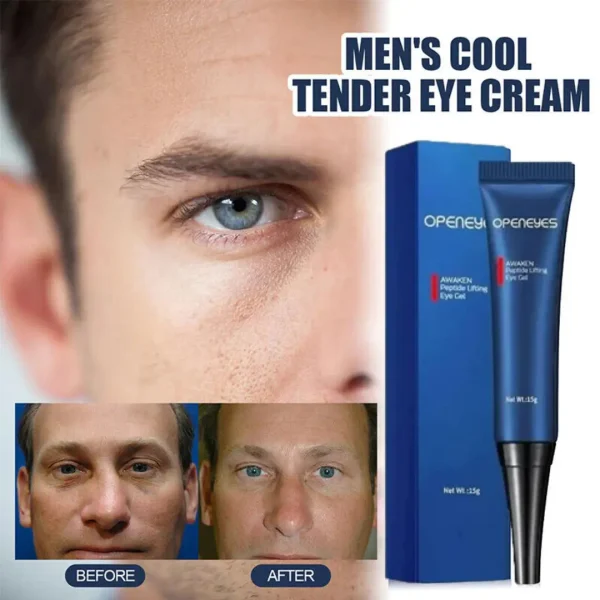 Openeyes - Crema Anti-Ojeras con Retinol AntiEdad