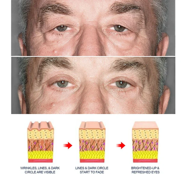 Openeyes - Crema Anti-Ojeras con Retinol AntiEdad, imagen 2